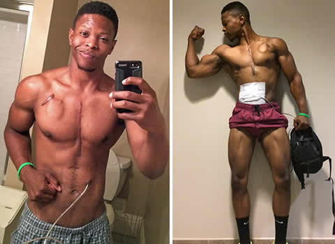 Andrew Jones heart transplant