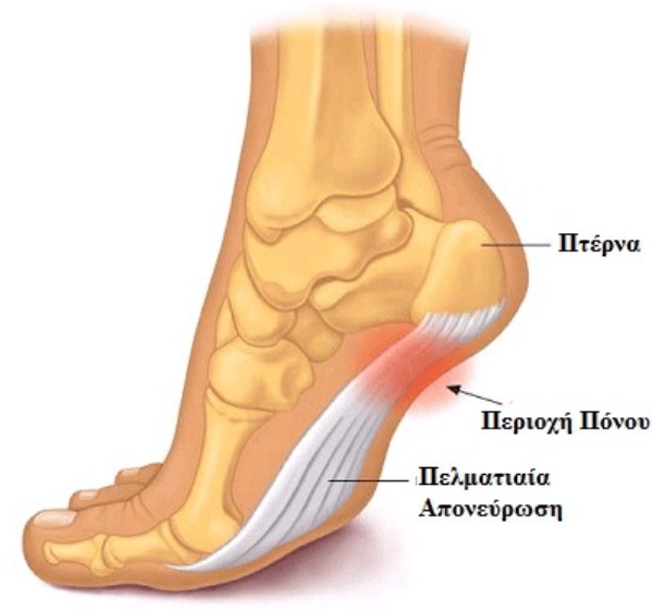 Plantar fasciitis Fascia Anatomy