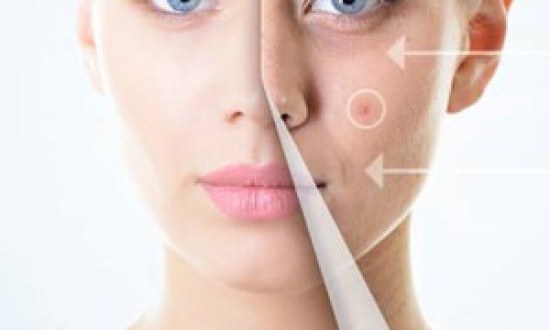 Η κακή συνήθεια που μας γερνά κατά 10 χρόνια !!!