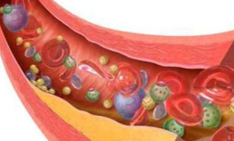 10 &tau;&rho;&omicron;&phi;έ&sigmaf; &pi;&omicron;&upsilon; &theta;&alpha; &kappa;&alpha;&theta;&alpha;&rho;ί&sigma;&omicron;&upsilon;&nu; &tau;&iota;&sigmaf; &alpha;&rho;&tau;&eta;&rho;ί&epsilon;&sigmaf; &sigma;&alpha;&sigmaf; &kappa;&alpha;&iota; &theta;&alpha; &kappa;ά&nu;&omicron;&upsilon;&nu; &tau;&eta;&nu; &kappa;&alpha;&rho;&delta;&iota;ά &sigma;&alpha;&sigmaf; "&alpha;&tau;&sigma;ά&lambda;&iota;&nu;&eta;"