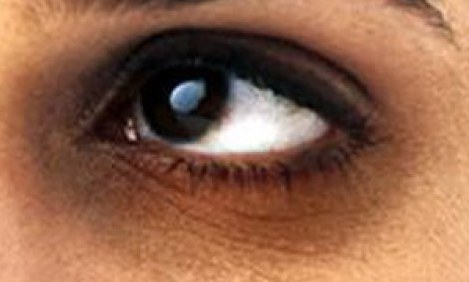 &Mu;&alpha;ύ&rho;&omicron;&iota; &kappa;ύ&kappa;&lambda;&omicron;&iota; &kappa;&alpha;&iota; &pi;ώ&sigmaf; &nu;&alpha; &tau;&omicron;&upsilon;&sigmaf; &alpha;&nu;&tau;&iota;&mu;&epsilon;&tau;&omega;&pi;ί&sigma;&epsilon;&tau;&epsilon;