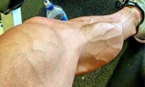 6 &sigma;&eta;&mu;&alpha;&nu;&tau;&iota;&kappa;ά &lambda;ά&theta;&eta; &sigma;&tau;&eta; &pi;&rho;&omicron;&pi;ό&nu;&eta;&sigma;&eta; &gamma;ά&mu;&pi;&alpha;&sigmaf;