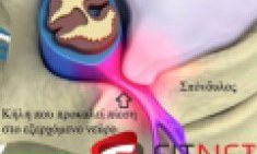 &Omicron;&sigma;&phi;&upsilon;ϊ&kappa;ή &delta;&iota;&sigma;&kappa;&omicron;&kappa;ή&lambda;&eta; / &kappa;ή&lambda;&eta; &mu;&epsilon;&sigma;&omicron;&sigma;&pi;&omicron;&nu;&delta;&upsilon;&lambda;ί&omicron;&upsilon; &delta;ί&sigma;&kappa;&omicron;&upsilon; by Fitnet team