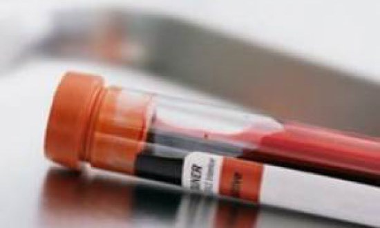 Λιπιδαιμικό προφίλ και αθλητισμός