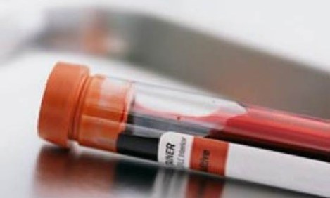 &Lambda;&iota;&pi;&iota;&delta;&alpha;&iota;&mu;&iota;&kappa;ό &pi;&rho;&omicron;&phi;ί&lambda; &kappa;&alpha;&iota; &alpha;&theta;&lambda;&eta;&tau;&iota;&sigma;&mu;ό&sigmaf;