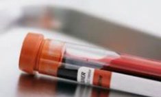 &Lambda;&iota;&pi;&iota;&delta;&alpha;&iota;&mu;&iota;&kappa;ό &pi;&rho;&omicron;&phi;ί&lambda; &kappa;&alpha;&iota; &alpha;&theta;&lambda;&eta;&tau;&iota;&sigma;&mu;ό&sigmaf;