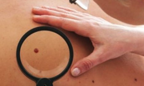 ''&Alpha;&theta;ώ&alpha;'' &epsilon;&lambda;&iota;ά ή &mu;&epsilon;&lambda;ά&nu;&omega;&mu;&alpha;: &Tau;&alpha; &sigma;&eta;&mu;ά&delta;&iota;&alpha; SOS