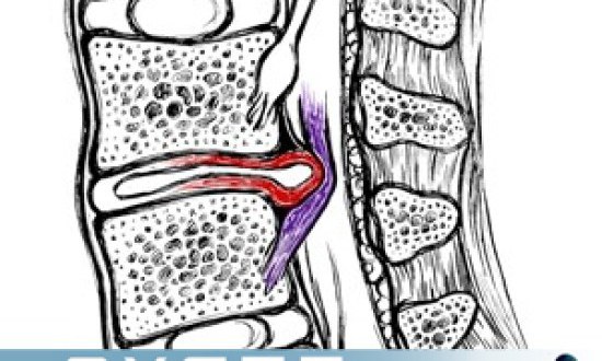 &Gamma;&upsilon;&mu;&nu;&alpha;&sigma;&tau;&iota;&kappa;ή &gamma;&iota;&alpha; &tau;&eta; &delta;&iota;&sigma;&kappa;&omicron;&pi;ά&theta;&epsilon;&iota;&alpha;