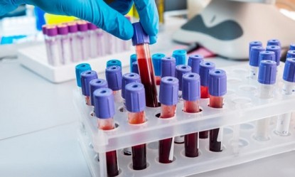 &Tau;&omicron; &tau;&epsilon;&sigma;&tau; &alpha;ί&mu;&alpha;&tau;&omicron;&sigmaf; &pi;&omicron;&upsilon; &alpha;&pi;&omicron;&kappa;&alpha;&lambda;ύ&pi;&tau;&epsilon;&iota; &tau;&iota;... ώ&rho;&alpha; &epsilon;ί&nu;&alpha;&iota; &mu;έ&sigma;&alpha; &sigma;&tau;&omicron; &sigma;ώ&mu;&alpha; &mu;&alpha;&sigmaf;!