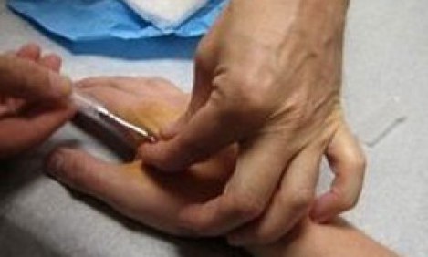 &Upsilon;&pi;&omicron;&chi;&rho;&epsilon;&omega;&tau;&iota;&kappa;ό &theta;&alpha; &epsilon;ί&nu;&alpha;&iota; &tau;&omicron; Microchip &gamma;&iota;&alpha; ό&lambda;&alpha; &tau;&alpha; &beta;&rho;έ&phi;&eta; &alpha;&pi;ό &tau;&omicron; &Mu;ά&iota;&omicron; &tau;&omicron;&upsilon; 2014!!!