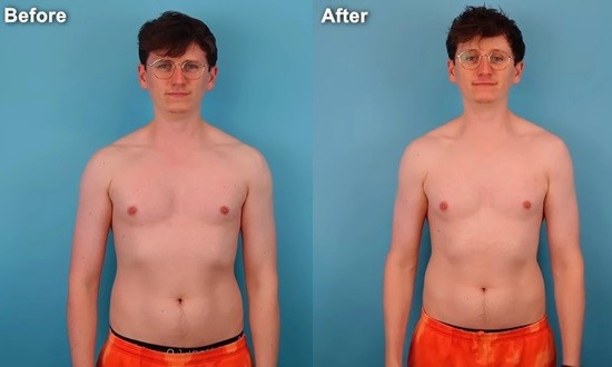 &Tau;&iota; &sigma;&upsilon;&nu;έ&beta;&eta; &sigma;&tau;&omicron; &sigma;ώ&mu;&alpha; &epsilon;&nu;ό&sigmaf; 28&chi;&rho;&omicron;&nu;&omicron;&upsilon; &pi;&omicron;&upsilon; &pi;&epsilon;&rho;&pi;&alpha;&tau;&omicron;ύ&sigma;&epsilon; 27 &chi;&iota;&lambda;&iota;ό&mu;&epsilon;&tau;&rho;&alpha; &tau;&eta;&nu; &eta;&mu;έ&rho;&alpha; &gamma;&iota;&alpha; &mu;ί&alpha; &epsilon;&beta;&delta;&omicron;&mu;ά&delta;&alpha;