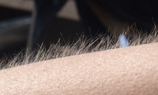 Το ξέρατε; Γιατί ανατριχιάζουμε όταν ακούμε το αγαπημένο μας τραγούδι