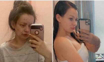 Έ&kappa;&omicron;&psi;&epsilon; &tau;&alpha; &nu;&alpha;&rho;&kappa;&omega;&tau;&iota;&kappa;ά &kappa;&alpha;&iota;&hellip; &mu;&epsilon;&tau;&alpha;&mu;&omicron;&rho;&phi;ώ&theta;&eta;&kappa;&epsilon;!