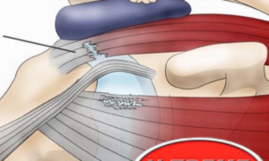 &Tau;&epsilon;&nu;&omicron;&nu;&tau;ί&tau;&iota;&delta;&alpha; &Upsilon;&pi;&epsilon;&rho;&alpha;&kappa;&alpha;&nu;&theta;ί&omicron;&upsilon; by Xtreme stores