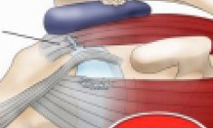 &Tau;&epsilon;&nu;&omicron;&nu;&tau;ί&tau;&iota;&delta;&alpha; &Upsilon;&pi;&epsilon;&rho;&alpha;&kappa;&alpha;&nu;&theta;ί&omicron;&upsilon; by Xtreme stores