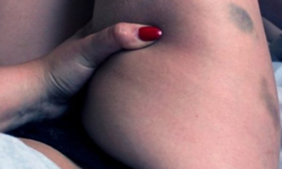 &Tau;&omicron; &alpha;&pi;ί&theta;&alpha;&nu;&omicron; &kappa;ό&lambda;&pi;&omicron; &gamma;&iota;&alpha; &nu;&alpha; &epsilon;&xi;&alpha;&phi;&alpha;&nu;ί&sigma;&epsilon;&tau;&epsilon; &tau;&iota;&sigmaf; &mu;&epsilon;&lambda;&alpha;&nu;&iota;έ&sigmaf;!