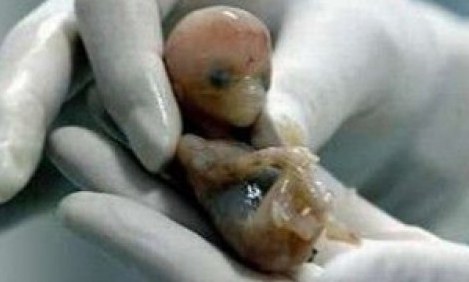 &Sigma;&Omicron;&Kappa;&Alpha;&Rho;&Iota;&Sigma;&Tau;&Iota;&Kappa;&Omicron;! &Kappa;&alpha;&tau;&alpha;&nu;&alpha;&lambda;ώ&nu;&omicron;&upsilon;&mu;&epsilon; &alpha;&nu;&theta;&rho;ώ&pi;&iota;&nu;&alpha; &Epsilon;&Mu;&Beta;&Rho;&Upsilon;&Alpha; &chi;&omega;&rho;ί&sigmaf; &nu;&alpha; &tau;&omicron; &gamma;&nu;&omega;&rho;ί&zeta;&omicron;&upsilon;&mu;&epsilon;!!!