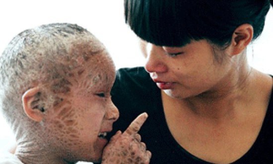 &Delta;&epsilon;ί&tau;&epsilon; &sigma;&pi;ά&nu;&iota;&epsilon;&sigmaf; &pi;&alpha;&theta;&omicron;&lambda;&omicron;&gamma;&iota;&kappa;έ&sigmaf; &alpha;&rho;&rho;ώ&sigma;&tau;&iota;&epsilon;&sigmaf;: &Phi;&Omega;&Tau;&Omicron; &Sigma;&Omicron;&Kappa;