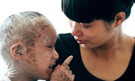 &Delta;&epsilon;ί&tau;&epsilon; &sigma;&pi;ά&nu;&iota;&epsilon;&sigmaf; &pi;&alpha;&theta;&omicron;&lambda;&omicron;&gamma;&iota;&kappa;έ&sigmaf; &alpha;&rho;&rho;ώ&sigma;&tau;&iota;&epsilon;&sigmaf;: &Phi;&Omega;&Tau;&Omicron; &Sigma;&Omicron;&Kappa;