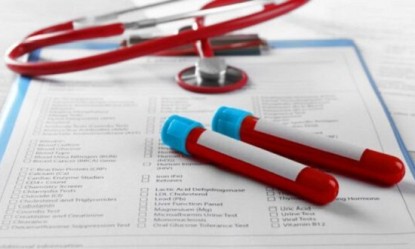 &Tau;&iota; &epsilon;ί&nu;&alpha;&iota; &eta; &kappa;&rho;&epsilon;&alpha;&tau;&iota;&nu;&iota;&kappa;ή &kappa;&iota;&nu;ά&sigma;&eta; &kappa;&alpha;&iota; &pi;&omicron;&iota;&omicron;&sigmaf; &epsilon;ί&nu;&alpha;&iota; &omicron; &rho;ό&lambda;&omicron;&sigmaf; &tau;&eta;&sigmaf;;