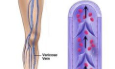 &Delta;&omega;&rho;&epsilon;ά&nu; &iota;&alpha;&tau;&rho;&iota;&kappa;έ&sigmaf; &epsilon;&xi;&epsilon;&tau;ά&sigma;&epsilon;&iota;&sigmaf; &gamma;&iota;&alpha; &tau;&iota;&sigmaf; &phi;&lambda;&epsilon;&beta;&iota;&kappa;έ&sigmaf; &pi;&alpha;&theta;ή&sigma;&epsilon;&iota;&sigmaf;