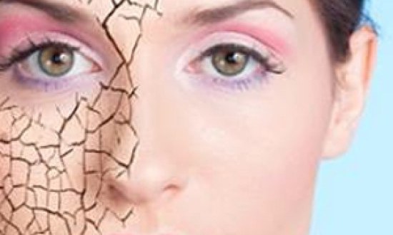 Το δέρμα υποφέρει από αφυδάτωση το καλοκαίρι. Γράφει ο Επ. Χριστόπουλος