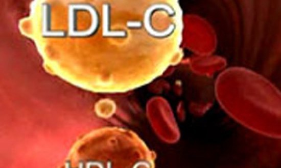 &Eta; &kappa;&alpha;&lambda;ή &eta; &kappa;&alpha;&kappa;ή (&chi;&omicron;&lambda;&iota;&sigma;&tau;&epsilon;&rho;ί&nu;&eta;) &kappa;&alpha;&iota; &eta; ά&sigma;&kappa;&eta;&sigma;&eta;..