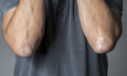 &Pi;&omicron;&iota;&omicron;&iota; &pi;&alpha;&rho;ά&gamma;&omicron;&nu;&tau;&epsilon;&sigmaf; &chi;&epsilon;&iota;&rho;&omicron;&tau;&epsilon;&rho;&epsilon;ύ&omicron;&upsilon;&nu; &tau;&eta;&nu; &psi;&omega;&rho;ί&alpha;&sigma;&eta; &sigma;&epsilon; &delta;έ&rho;&mu;&alpha; &kappa;&alpha;&iota; &nu;ύ&chi;&iota;&alpha;