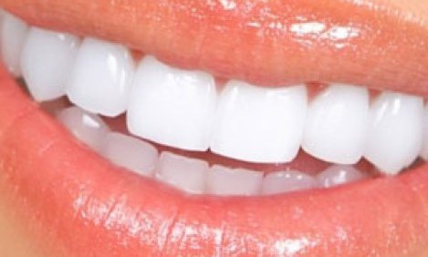 &Omicron;&iota; 4 &tau;&rho;&omicron;&phi;έ&sigmaf; &pi;&omicron;&upsilon; &lambda;&epsilon;&upsilon;&kappa;&alpha;ί&nu;&omicron;&upsilon;&nu; &tau;&alpha; &delta;ό&nu;&tau;&iota;&alpha; &alpha;&nu; &tau;&iota;&sigmaf; &tau;&rho;ώ&tau;&epsilon; &pi;&rho;&omega;ί !!!