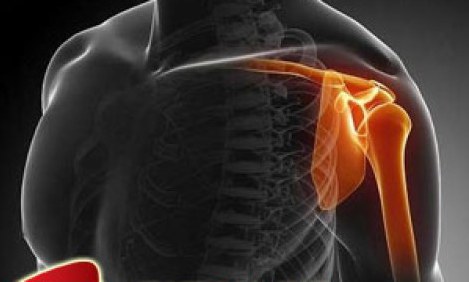 &Eta; &omega;&mu;&omicron;&pi;&lambda;ά&tau;&eta;, &eta; ά&rho;&theta;&rho;&omega;&sigma;&eta; &tau;&omicron;&upsilon; ώ&mu;&omicron;&upsilon; &kappa;&alpha;&iota; &omicron; &tau;&rho;&alpha;&pi;&epsilon;&zeta;&omicron;&epsilon;&iota;&delta;ή&sigmaf;- Έ&nu;&alpha; &epsilon;&nu;&delta;&iota;&alpha;&phi;έ&rho;&omicron;&nu; &pi;&alpha;&rho;ά&delta;&epsilon;&iota;&gamma;&mu;&alpha; &sigma;&upsilon;&nu;&epsilon;&rho;&gamma;&alpha;&sigma;ί&alpha;&sigmaf; &tau;&omicron;&upsilon; &mu;&upsilon;&omicron;&sigma;&kappa;&epsilon;&lambda;&epsilon;&tau;&iota;&kappa;&omicron;ύ &sigma;&upsilon;&sigma;&tau;ή&mu;&alpha;&tau;&omicron;&sigmaf;.