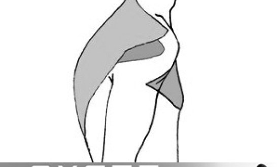 Πως να διορθόσω την κύφωση/καμπούρα