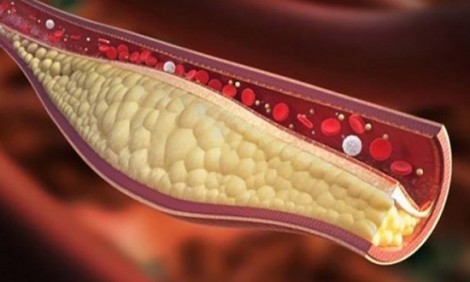 Θέλετε να... ξεβουλώσετε άμεσα τις αρτηρίες σας; Πιείτε αυτό!