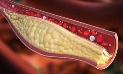 &Theta;έ&lambda;&epsilon;&tau;&epsilon; &nu;&alpha;... &xi;&epsilon;&beta;&omicron;&upsilon;&lambda;ώ&sigma;&epsilon;&tau;&epsilon; ά&mu;&epsilon;&sigma;&alpha; &tau;&iota;&sigmaf; &alpha;&rho;&tau;&eta;&rho;ί&epsilon;&sigmaf; &sigma;&alpha;&sigmaf;; &Pi;&iota;&epsilon;ί&tau;&epsilon; &alpha;&upsilon;&tau;ό!