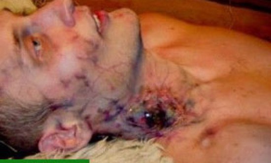 ΚΟΚΚΙΝΟΣ ΣΥΝΑΓΕΡΜΟΣ για τον Έμπολα: Θέμα χρόνου να εξαπλωθεί σε ολόκληρο τον κόσμο