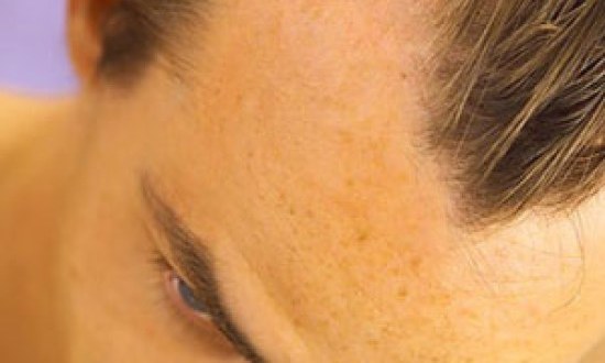 &Tau;&rho;&iota;&chi;ό&pi;&tau;&omega;&sigma;&eta;: &Gamma;&iota;&alpha;&tau;ί &pi;έ&phi;&tau;&omicron;&upsilon;&nu; &tau;&alpha; &mu;&alpha;&lambda;&lambda;&iota;ά &mu;&alpha;&sigmaf; &tau;&omicron; &phi;&theta;&iota;&nu;ό&pi;&omega;&rho;&omicron;;