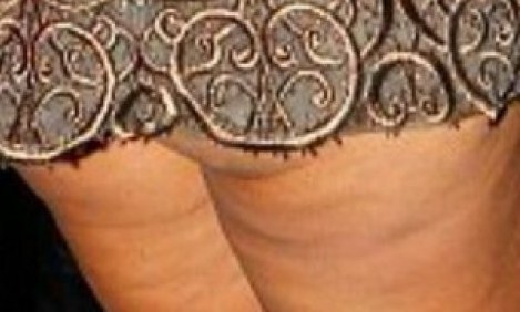 &Delta;&epsilon;ί&tau;&epsilon; &tau;&eta;&nu; 58&chi;&rho;&omicron;&nu;&eta; &mu;ά&nu;&alpha; &delta;&iota;ά&sigma;&eta;&mu;&eta;&sigmaf; &sigma;&tau;&alpha;&rho; &mu;&epsilon; &mu;ί&nu;&iota; &kappa;&alpha;&iota; &kappa;&upsilon;&tau;&tau;&alpha;&rho;ί&tau;&iota;&delta;&alpha;!