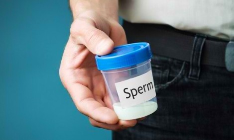 Ειδικός εξηγεί γιατί μειώνονται κάθε χρόνο τα σπερματοζωάρια στον κόσμο