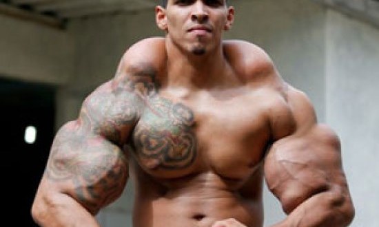 Ηθελε να μοιάσει στον Hulk και δείτε πως έγινε – Η σοκαριστική μεταμόρφωση που έθεσε σε κίνδυνο τη ζωή του