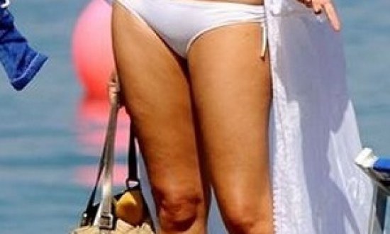 Δείτε γνωστή ηθοποιό που έχει την κυτταρίτιδά της!