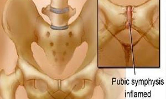 &Eta;&beta;&iota;&kappa;ή &omicron;&sigma;&tau;&epsilon;ΐ&tau;&iota;&delta;&alpha;. &Gamma;&rho;ά&phi;&epsilon;&iota; &omicron; &Sigma;&tau;&alpha;ύ&rho;&omicron;&sigmaf; &Pi;&alpha;&pi;&alpha;&delta;ό&pi;&omicron;&upsilon;&lambda;&omicron;&sigmaf;