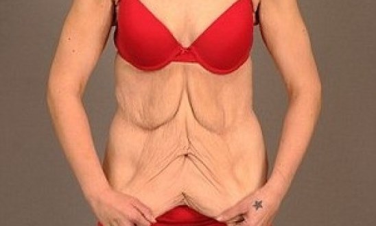 &Sigma;&Omicron;&Kappa;: Έ&chi;&alpha;&sigma;&epsilon; 60 &kappa;&iota;&lambda;ά &kappa;&alpha;&iota; &tau;&eta;&nu; &sigma;&iota;&chi;ά&theta;&eta;&kappa;&epsilon; &omicron; ά&nu;&tau;&rho;&alpha;&sigmaf; &tau;&eta;&sigmaf;! (photos)