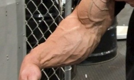 &Eta; &phi;&lambda;&epsilon;&beta;&iota;&kappa;ό&tau;&eta;&tau;&alpha; &epsilon;ί&nu;&alpha;&iota; &mu;ό&nu;&omicron; &sigma;&tau;&alpha; &gamma;&omicron;&nu;ί&delta;&iota;&alpha;;