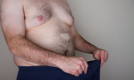 &Pi;&omega;&sigmaf; &eta; &pi;&alpha;&chi;&upsilon;&sigma;&alpha;&rho;&kappa;ί&alpha; &sigma;&tau;έ&kappa;&epsilon;&tau;&alpha;&iota; &epsilon;&mu;&pi;ό&delta;&iota;&omicron; &sigma;&tau;&eta;&nu; &sigma;&epsilon;&xi;&omicron;&upsilon;&alpha;&lambda;&iota;&kappa;ή &zeta;&omega;ή