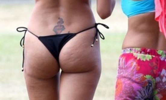 Τα πιο διάσημα μοντέλα έχουν κυτταρίτιδα (photos)