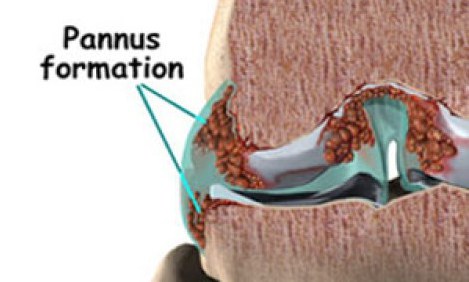 &Alpha;&rho;&theta;&rho;ί&tau;&iota;&delta;&alpha;, &rho;&epsilon;&upsilon;&mu;&alpha;&tau;&omicron;&epsilon;&iota;&delta;ή&sigmaf; &alpha;&rho;&theta;&rho;ί&tau;&iota;&delta;&alpha; &kappa;&alpha;&iota; &alpha;&sigma;&kappa;&eta;&sigma;&eta; -