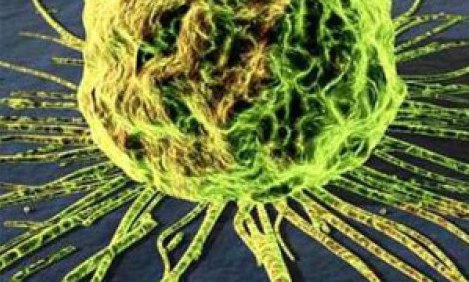 Έ&xi;&alpha;&rho;&sigma;&eta; &tau;&omega;&nu; &alpha;&upsilon;&tau;&omicron;ά&nu;&omicron;&sigma;&omega;&nu; &alpha;&pi;ό &tau;&omicron; &sigma;&tau;&rho;&epsilon;&sigmaf; &kappa;&alpha;&iota; &tau;&iota;&sigmaf; &tau;&omicron;&xi;&iota;&kappa;έ&sigmaf; &omicron;&upsilon;&sigma;ί&epsilon;&sigmaf; - SOS !!!