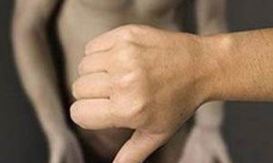 Η ΣΤΥΤΙΚΗ ∆ΥΣΛΕΙΤΟΥΡΓΙΑ ΕΙΝΑΙ ΠΡΟΕΙ∆ΟΠΟΙΗΤΙΚΟ ΣΗΜΑ∆Ι ΓΙΑ ΣΟΒΑΡΕΣ ΑΣΘΕΝΕΙΕΣ