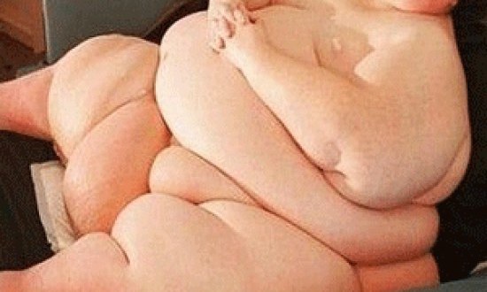 ΑΠΙΣΤΕΥΤΗ ΜΕΤΑΜΟΡΦΩΣΗ: Ο βαρύτερος άνθρωπος του πλανήτη έχασε 280 κιλά! Δείτε πως είναι σήμερα (PHOTOS)