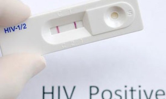 &Omicron;&rho;&omicron;&theta;&epsilon;&tau;&iota;&kappa;ό&sigmaf; &phi;&omicron;&iota;&tau;&eta;&tau;ή&sigmaf; &mu;&epsilon;&tau;έ&delta;&omega;&sigma;&epsilon; &epsilon;&sigma;&kappa;&epsilon;&mu;&mu;έ&nu;&alpha; &tau;&omicron;&nu; HIV &sigma;&epsilon; 30 ά&tau;&omicron;&mu;&alpha;
