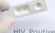 &Omicron;&rho;&omicron;&theta;&epsilon;&tau;&iota;&kappa;ό&sigmaf; &phi;&omicron;&iota;&tau;&eta;&tau;ή&sigmaf; &mu;&epsilon;&tau;έ&delta;&omega;&sigma;&epsilon; &epsilon;&sigma;&kappa;&epsilon;&mu;&mu;έ&nu;&alpha; &tau;&omicron;&nu; HIV &sigma;&epsilon; 30 ά&tau;&omicron;&mu;&alpha;